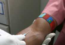 ZIMBABWE: HIV rate falls again ZIMBABWE: HIV rate falls again