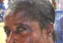 Skin Bleaching Skin Bleaching
