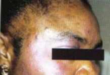 Dilemma of a black woman who wanted to be light skinned Dilemma of a black woman who wanted to be light skinned