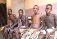 Côte d’Ivoire : Malnutrition concerns in country’s prisons Côte d’Ivoire : Malnutrition concerns in country’s prisons