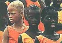 Albino body parts : A hot demand in Burundi