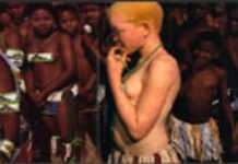 Tanzania’s taste for cold-blooded Albino killings