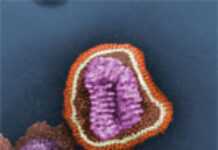Ethiopia: Swine flu/A-H1N1 testing in Kenya questioned Ethiopia: Swine flu/A-H1N1 testing in Kenya questioned