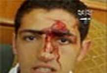 Egypt – Algeria: A dangerous and bloody football match Egypt – Algeria: A dangerous and bloody football match