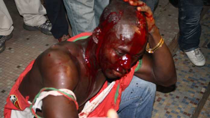 Injured policeman Injured policeman