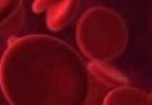 Discovering the warning signs of anaemia Discovering the warning signs of anaemia