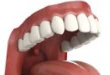 Bad breath: Time to talk about it Bad breath: Time to talk about it