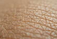 Overexposure to environmental stress like pollution, smoke, harsh weather and sun rays can accelerate skin ageing by triggering oxidative stress in the skin Skin